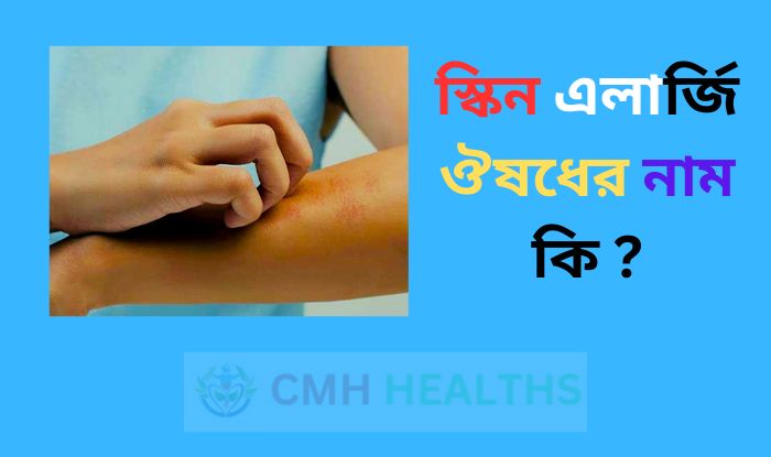 স্কিন এলার্জি ঔষধের নাম