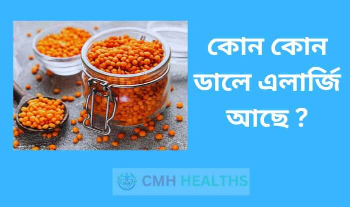 কোন কোন ডালে এলার্জি আছে