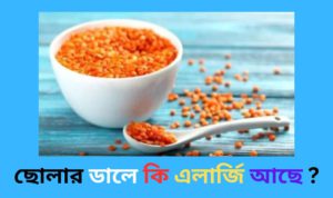 কোন কোন ডালে এলার্জি আছে