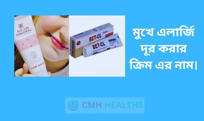 মুখে এলার্জি দূর করার ক্রিম