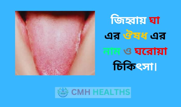 জিহ্বায় ঘা এর ঔষধ এর নাম