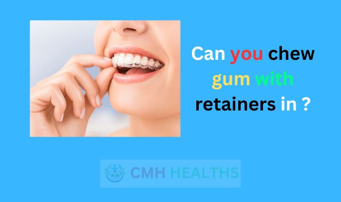 Can you chew gum with retainers