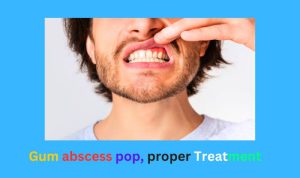 Gum abscess pop
