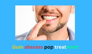 Gum abscess pop