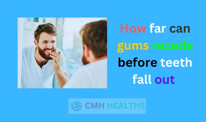 How far can gums recede before teeth fall out