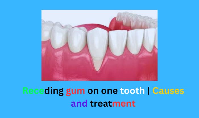 Receding gum on one tooth