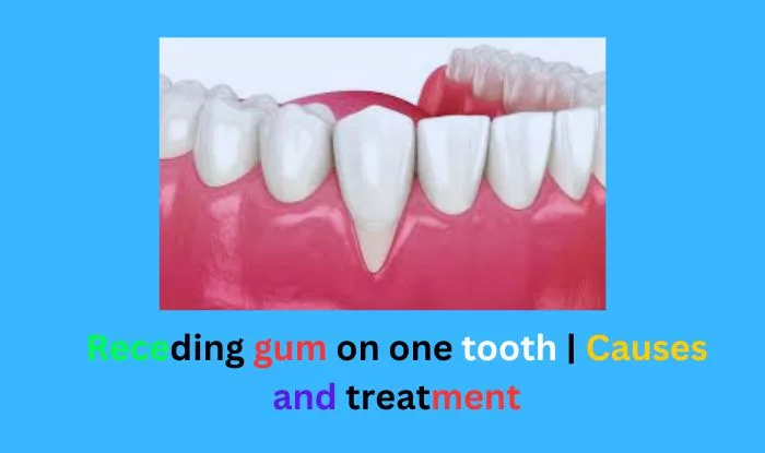 Receding gum on one tooth