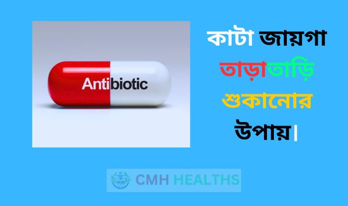 কাটা জায়গা তাড়াতাড়ি শুকানোর উপায়