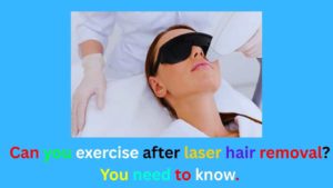 Can you exercise after laser hair removal